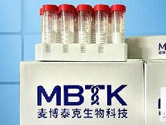 口蹄疫病毒快速浓缩纯化试剂盒